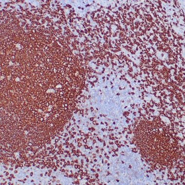 Anti-CD20 antibody [ZR243] IHC antibody paraffin tissue
