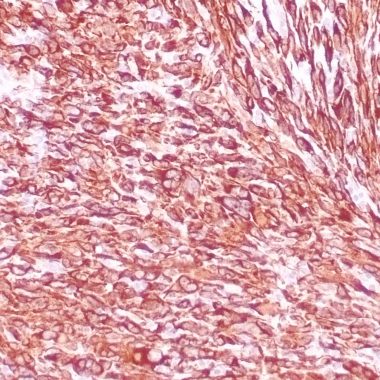 Anti-Desmin antibody (Full length) [ZR240] IHC antibody paraffin tissue
