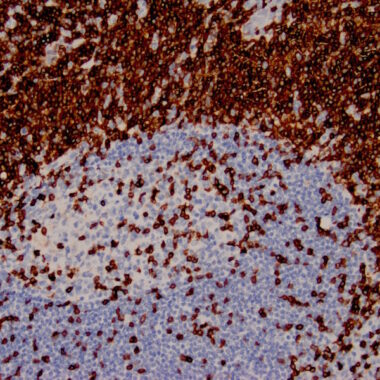 Anti-CD3 antibody [ZM45] IHC antibody paraffin tissue