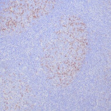 Anti-PDCD1 antibody (ECD) [ZR408] IHC antibody paraffin tissue