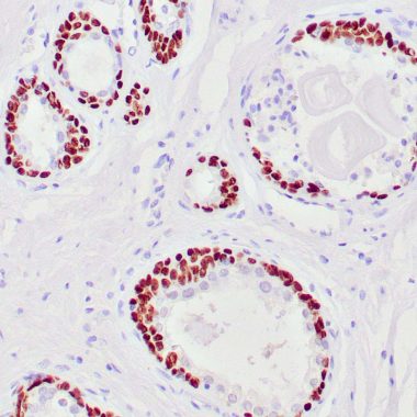 Anti-TP63 antibody (Full length) [4A4] IHC antibody paraffin tissue