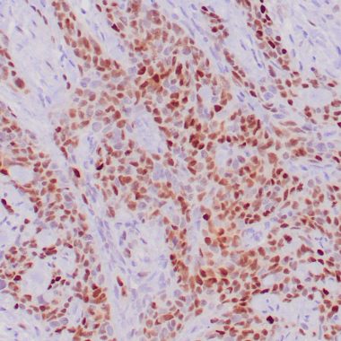 Anti-p21WAF1 antibody [ZR288] IHC antibody paraffin tissue