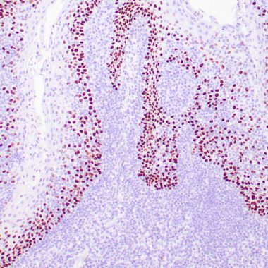 Anti-Recombinant-P40 antibody (N-Term) [ZR8] IHC antibody paraffin tissue