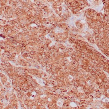 Anti-VEGF antibody [ZR389] IHC antibody paraffin tissue