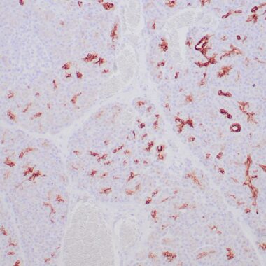 Anti-Cytokeratin 7 antibody (Full Length) [ZR428] IHC antibody paraffin tissue