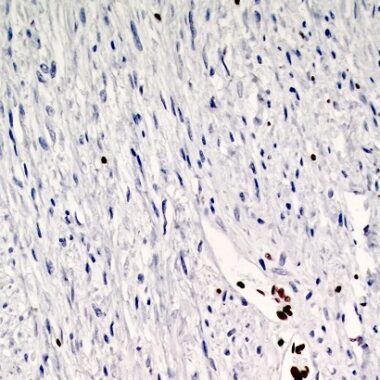 Anti-H3K27me3 antibody (N-Term) [ZR473] IHC antibody paraffin tissue