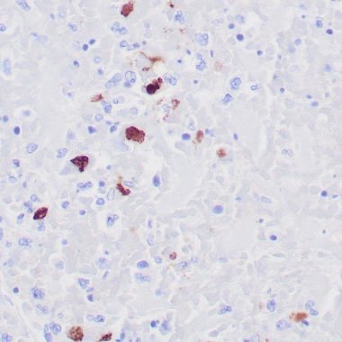 Anti-HSV I antibody [10A3] IHC antibody paraffin tissue