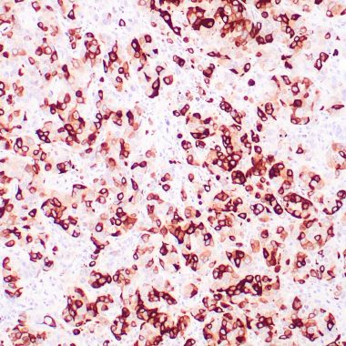 Anti-Mammaglobin antibody (Full length) [304‐1A5] IHC antibody paraffin tissue