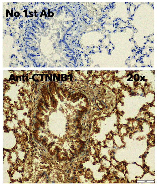Anti-CTNNB1 STJ140021
