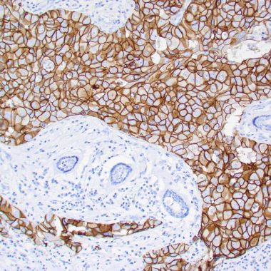 Anti-Recombinant-ERBB2 antibody (ECD) [ZR5] IHC antibody paraffin tissue