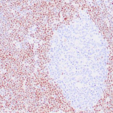 Anti-Cyclin D1 antibody (C-Term) [ZR197] IHC antibody paraffin tissue