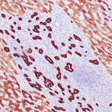 Anti-Pan-Cytokeratin antibody [OSCAR] IHC antibody paraffin tissue