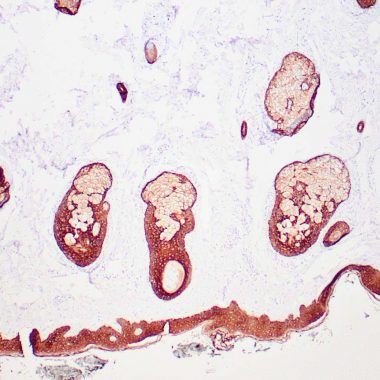Anti-Keratin, HMW antibody [34 Beta E12] IHC antibody paraffin tissue