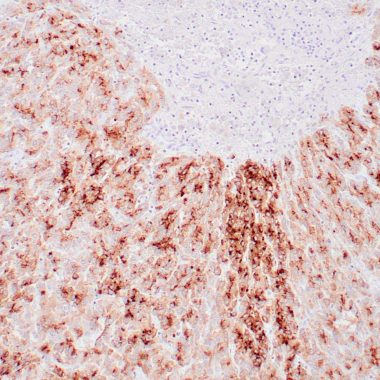 Anti-GPC3 antibody (C-term 70aa) [1G12] IHC antibody paraffin tissue