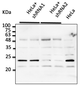 Anti-RAB7A STJ140063