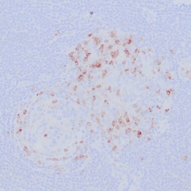 Anti-CTLA-4 antibody [ZR452] IHC antibody paraffin tissue
