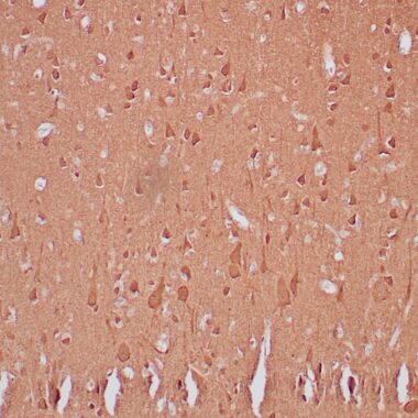Anti-NSE antibody (416-433aa) [ZR406] IHC antibody paraffin tissue