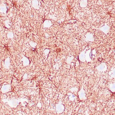 Anti-GFAP antibody [GA‐5] IHC antibody paraffin tissue