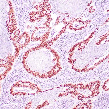 Anti-TP53 antibody [DO‐7] IHC antibody paraffin tissue