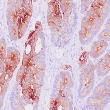 Anti-KRT20 antibody [Ks20.8] IHC antibody paraffin tissue