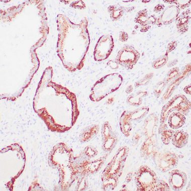 Anti-AMACR+P63+HMW CK antibody [13H4+4A4+34 Beta E12] IHC antibody paraffin tissue
