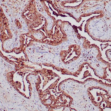 Anti-Napsin A antibody (189-299aa) [ZR206] IHC antibody paraffin tissue